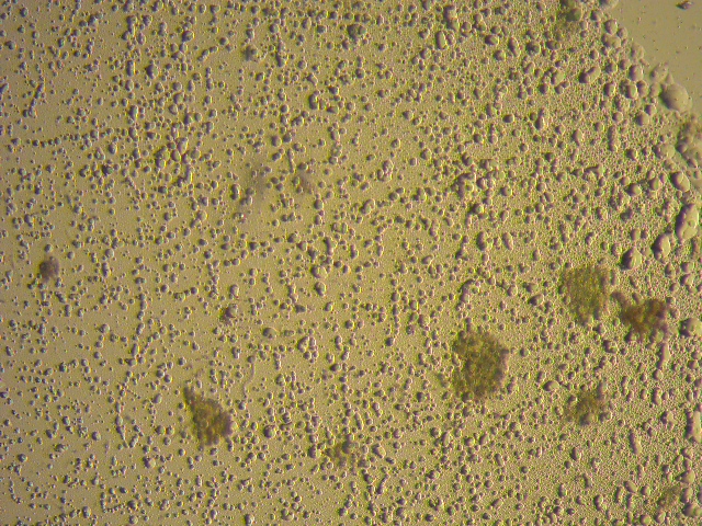 خلايا الطحالب الدقيقة قبل تحلل الخلايا