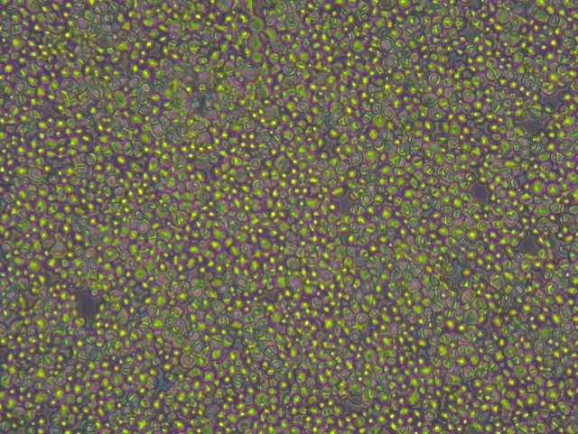 خلايا الخميرة قبل انحلال الخلاياs